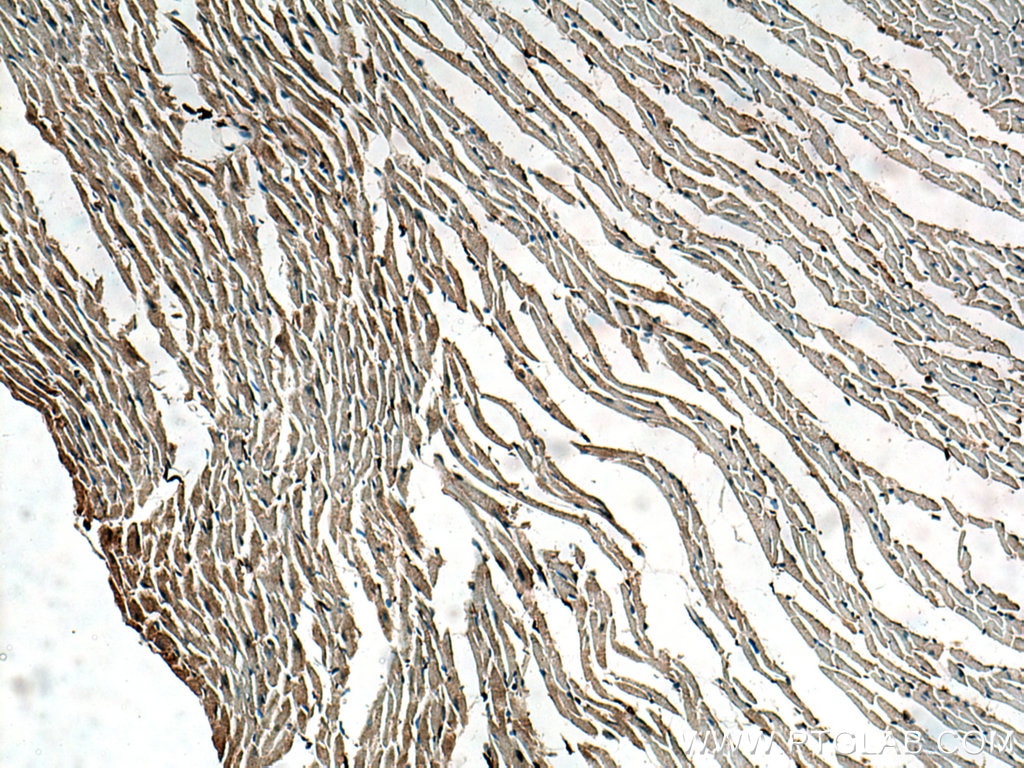 Immunohistochemistry (IHC) staining of mouse heart tissue using PPP1R12B Polyclonal antibody (13366-1-AP)