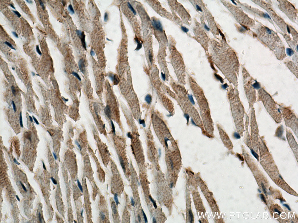 Immunohistochemistry (IHC) staining of mouse heart tissue using PPP1R12B Polyclonal antibody (13366-1-AP)