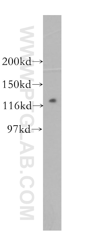 Western Blot (WB) analysis of mouse skeletal muscle tissue using PPP1R12B Polyclonal antibody (13366-1-AP)
