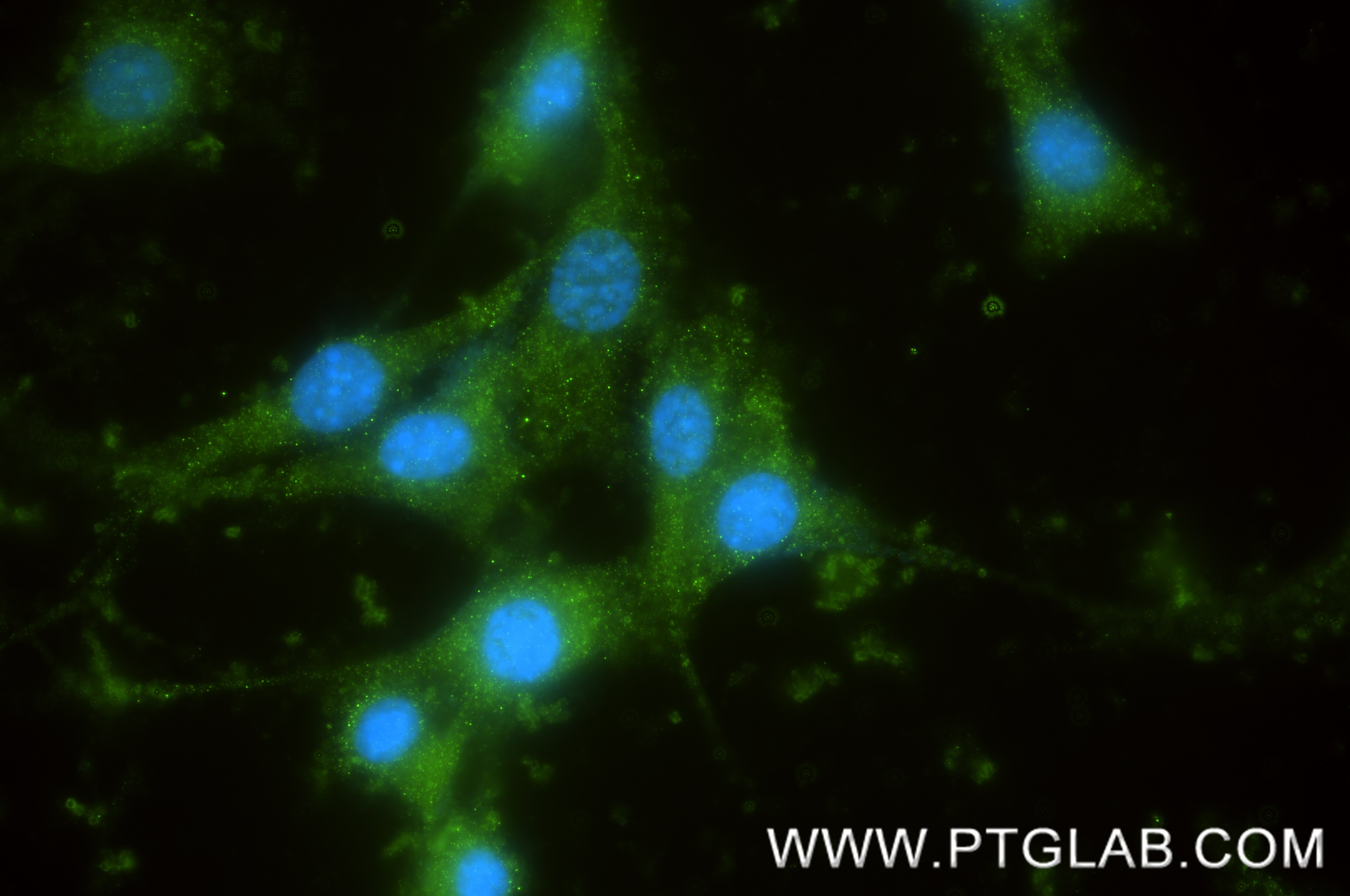 IF Staining of NIH/3T3 using 87808-1-RR Immunofluorescence (IF) / fluorescent staining of NIH/3T3 cells using PPP1R12B Recombinant monoclonal antibody (87808-1-RR)