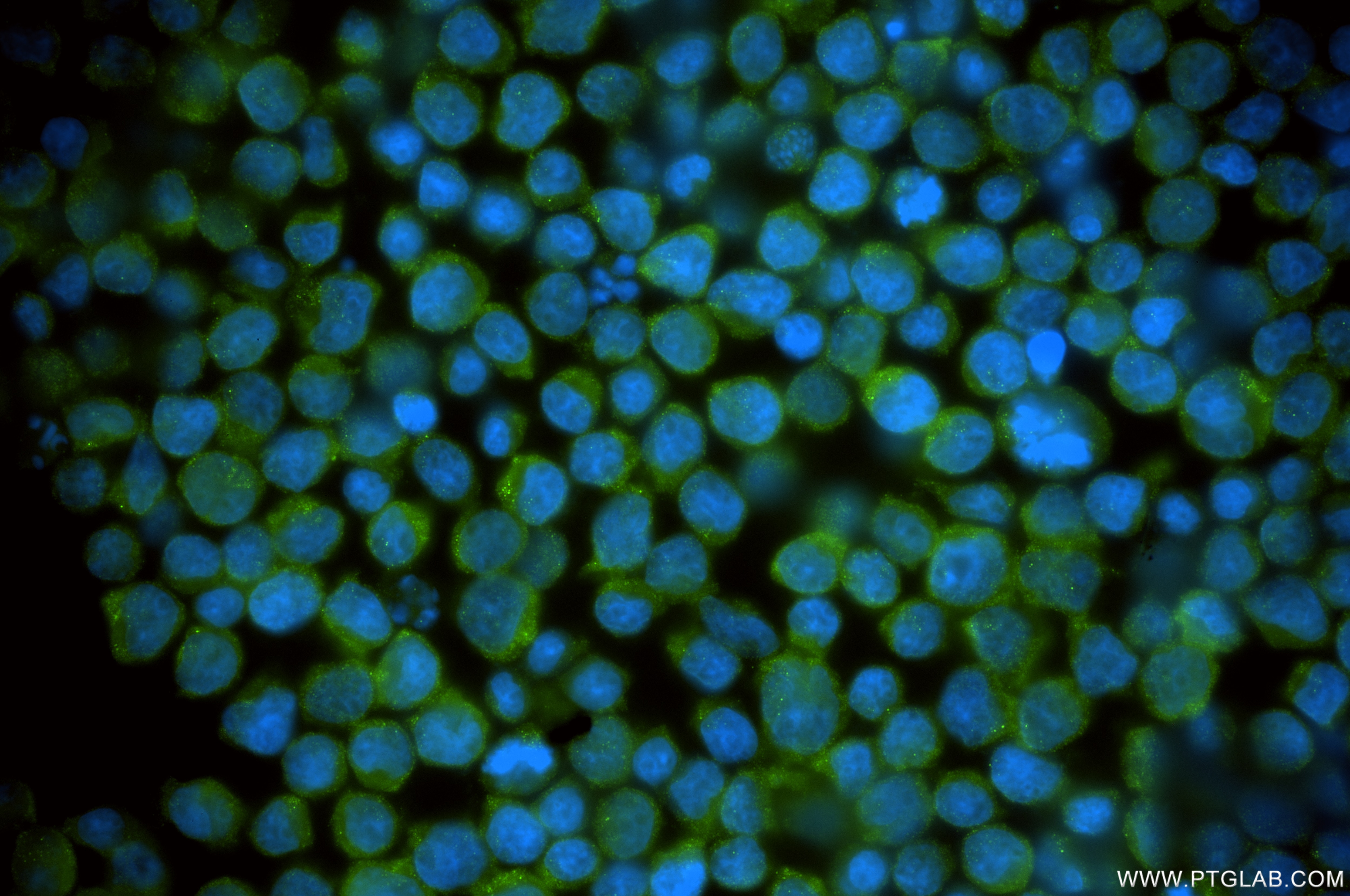 Immunofluorescence (IF) / fluorescent staining of Jurkat cells using PPP1R12C Recombinant monoclonal antibody (86583-1-RR)