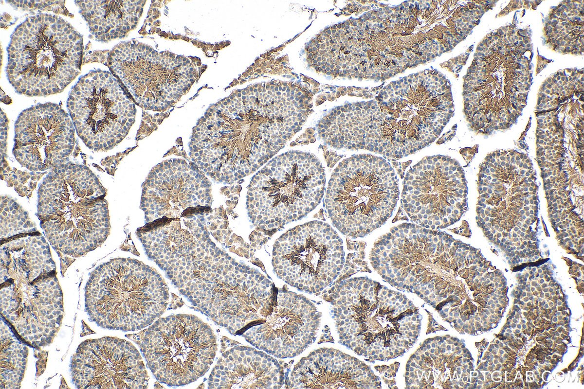 Immunohistochemistry (IHC) staining of mouse testis tissue using PPP1R13B Polyclonal antibody (29804-1-AP)