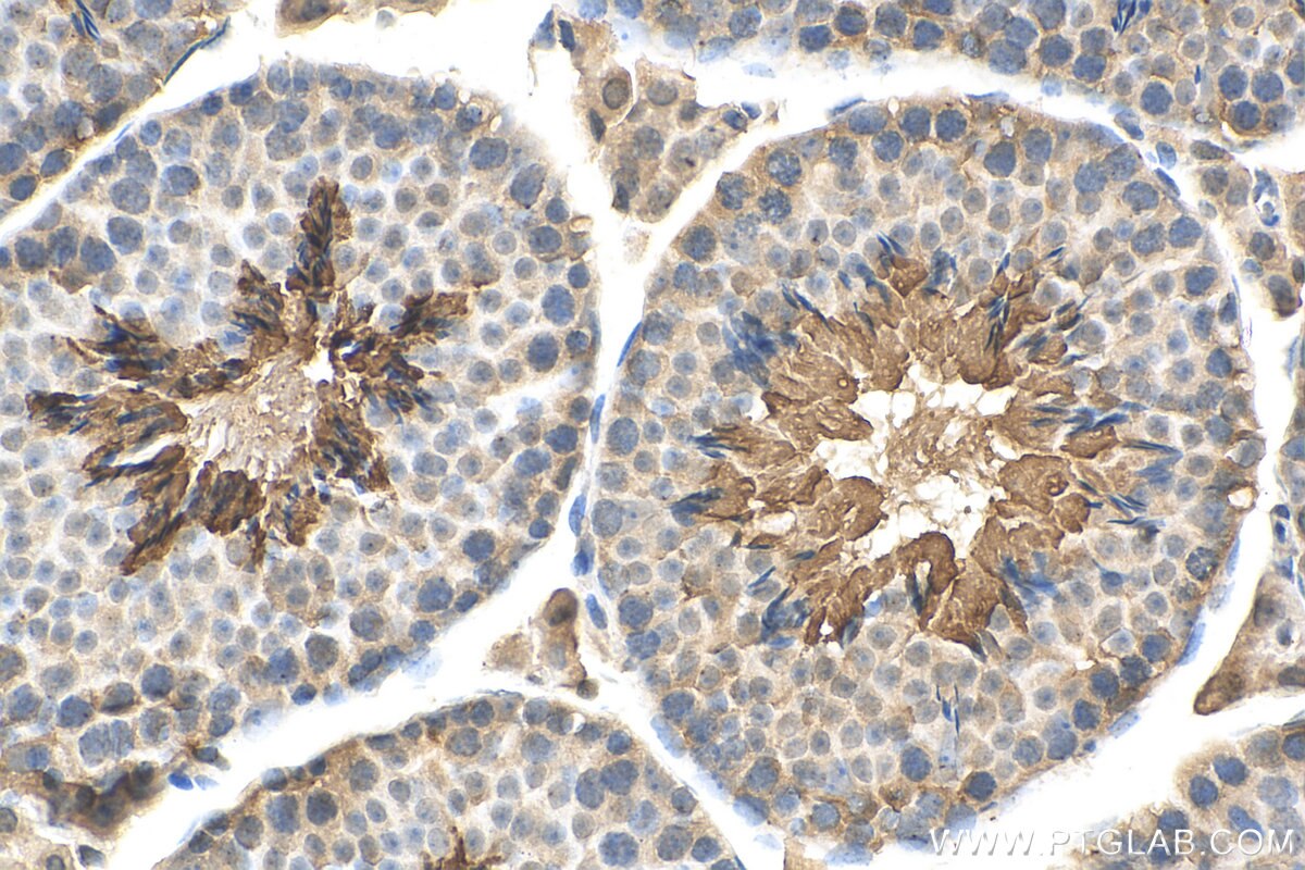 Immunohistochemistry (IHC) staining of mouse testis tissue using PPP1R13B Polyclonal antibody (29804-1-AP)