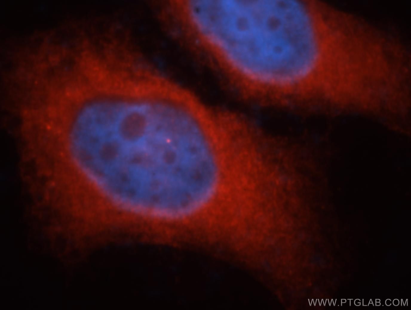Immunofluorescence (IF) / fluorescent staining of MCF-7 cells using iASPP Polyclonal antibody (18590-1-AP)