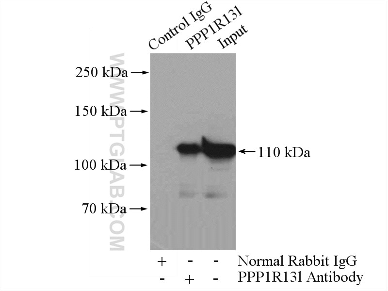 Immunoprecipitation (IP) experiment of PC-3 cells using iASPP Polyclonal antibody (18590-1-AP)