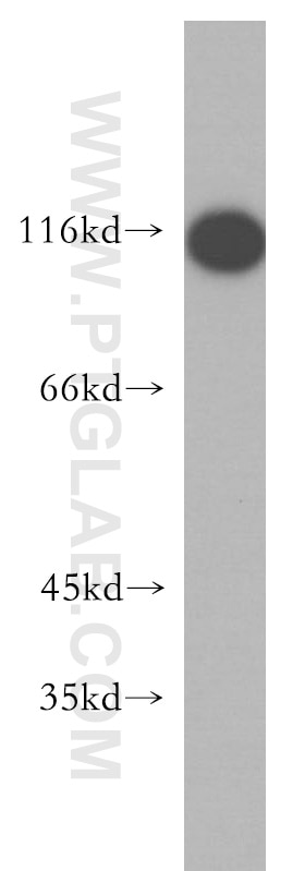 Western Blot (WB) analysis of PC-3 cells using iASPP Polyclonal antibody (18590-1-AP)