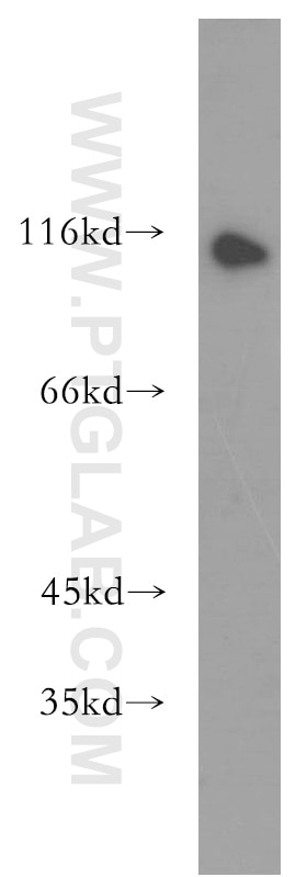 Western Blot (WB) analysis of MCF-7 cells using iASPP Polyclonal antibody (18590-1-AP)