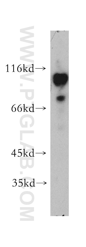 Western Blot (WB) analysis of Apoptosised HeLa cells using iASPP Polyclonal antibody (18590-1-AP)