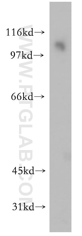 WB analysis of HEK-293 using 51141-1-AP