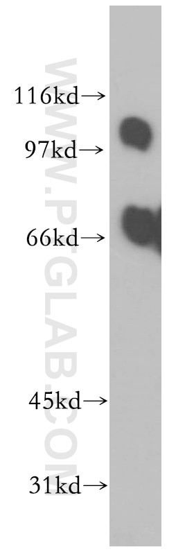 Western Blot (WB) analysis of mouse testis tissue using PPP1R13L Polyclonal antibody (51141-1-AP)