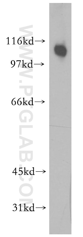 Western Blot (WB) analysis of human heart tissue using iASPP Polyclonal antibody (51141-1-AP)