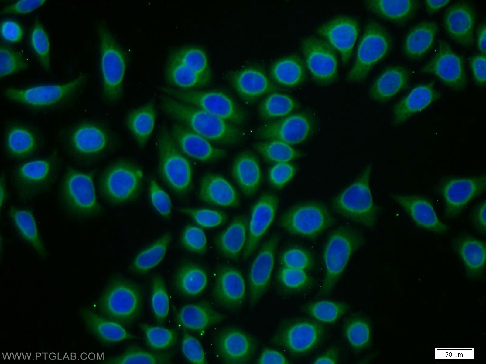 Immunofluorescence (IF) / fluorescent staining of PC-3 cells using CPI17 Polyclonal antibody (11658-1-AP)