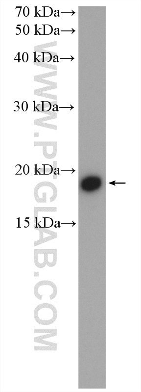 Western Blot (WB) analysis of Jurkat cells using CPI17 Polyclonal antibody (11658-1-AP)