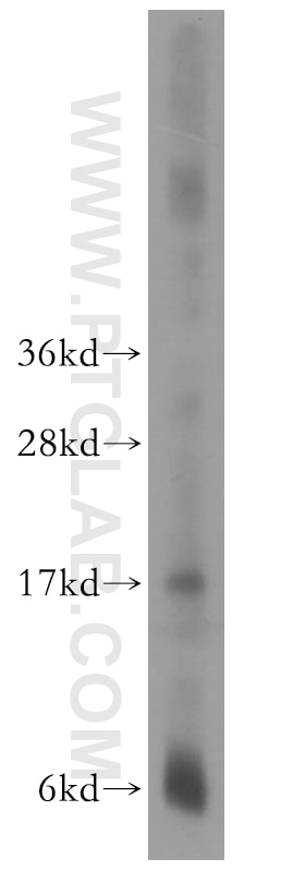 Western Blot (WB) analysis of human colon tissue using CPI17 Polyclonal antibody (11658-1-AP)