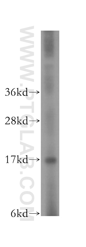 Western Blot (WB) analysis of PC-3 cells using CPI17 Polyclonal antibody (11658-1-AP)