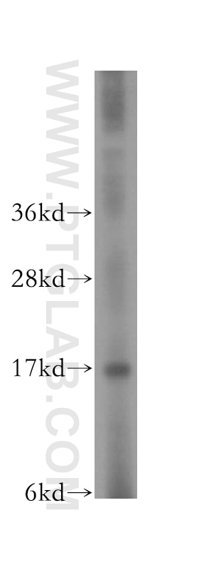 WB analysis of PC-3 using 11658-1-AP