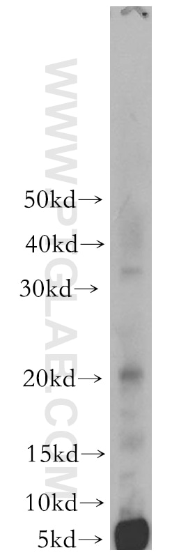 WB analysis of mouse liver using 18476-1-AP