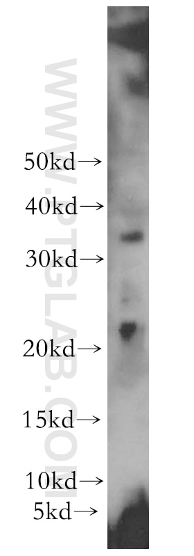 Western Blot (WB) analysis of human heart tissue using PPP1R14B Polyclonal antibody (18476-1-AP)