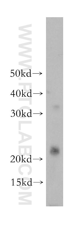 Western Blot (WB) analysis of mouse skeletal muscle tissue using PPP1R14B Polyclonal antibody (18476-1-AP)