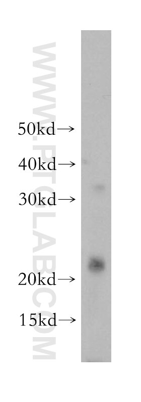 WB analysis of mouse skeletal muscle using 18476-1-AP