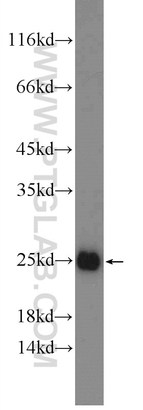 PPP1R14D Polyclonal antibody