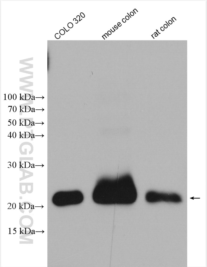 Western Blot (WB) analysis of various lysates using PPP1R14D Polyclonal antibody (22080-1-AP)