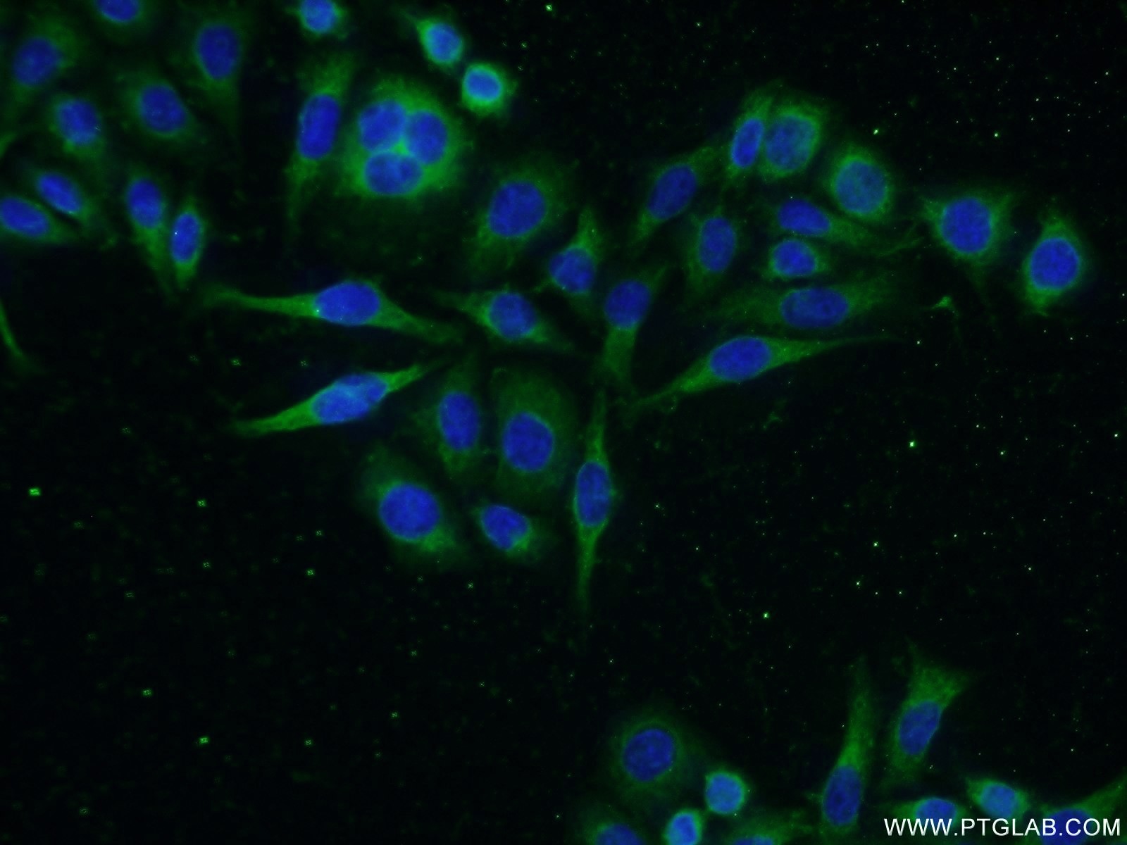 Immunofluorescence (IF) / fluorescent staining of PC-3 cells using GADD34 Polyclonal antibody (10449-1-AP)