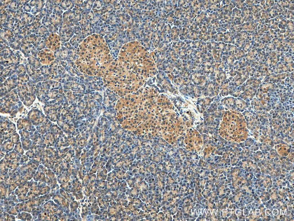 Immunohistochemistry (IHC) staining of human pancreas tissue using GADD34 Polyclonal antibody (10449-1-AP)