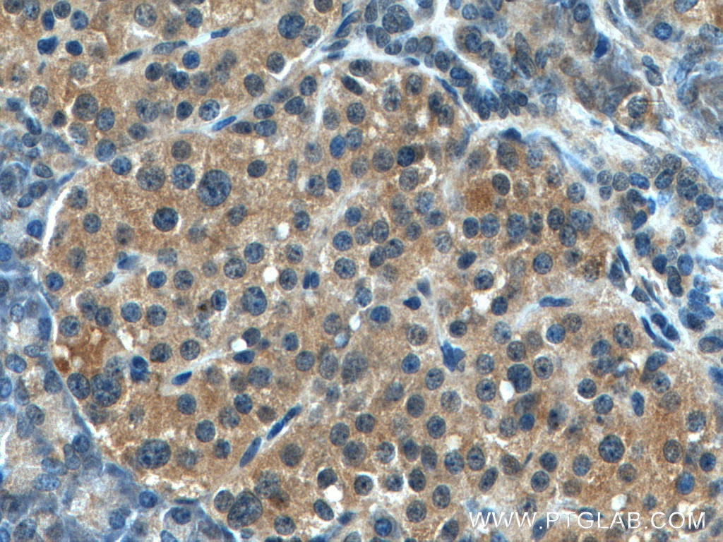 Immunohistochemistry (IHC) staining of human pancreas tissue using GADD34 Polyclonal antibody (10449-1-AP)