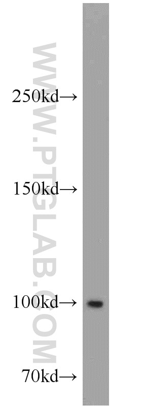 Western Blot (WB) analysis of HepG2 cells using GADD34 Polyclonal antibody (10449-1-AP)