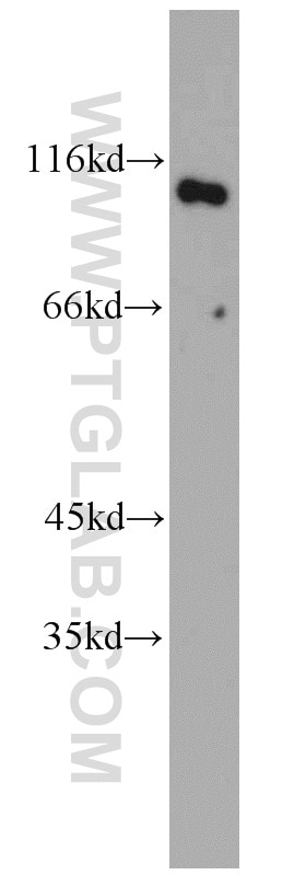 Western Blot (WB) analysis of Jurkat cells using GADD34 Polyclonal antibody (10449-1-AP)