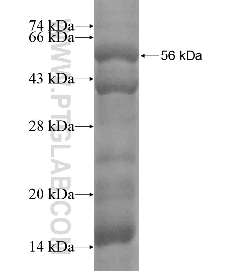 GADD34 fusion protein Ag19287 SDS-PAGE GADD34 fusion protein Ag19287 SDS-PAGE