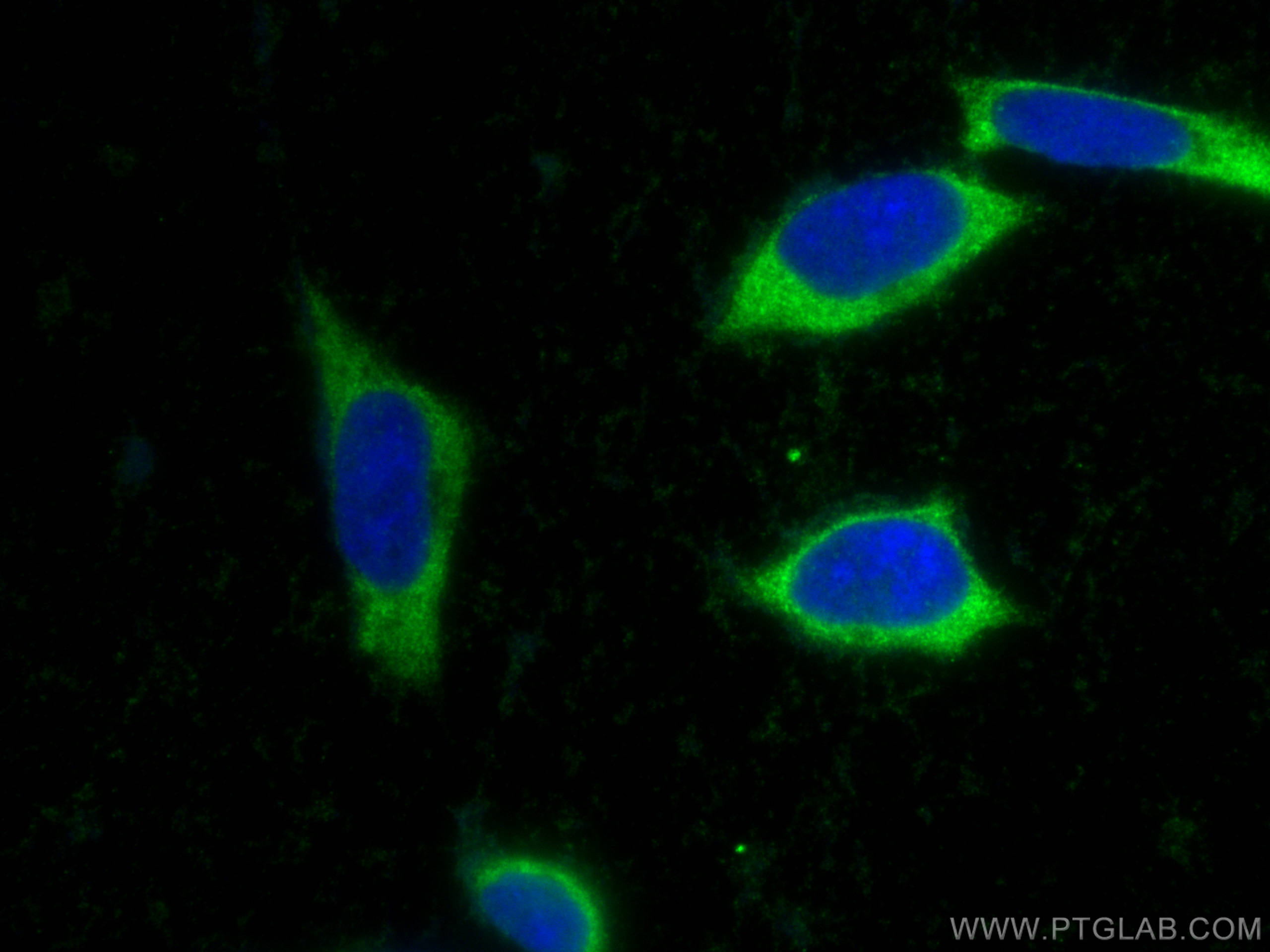 Immunofluorescence (IF) / fluorescent staining of SH-SY5Y cells using PPP1R15B Polyclonal antibody (14634-1-AP)