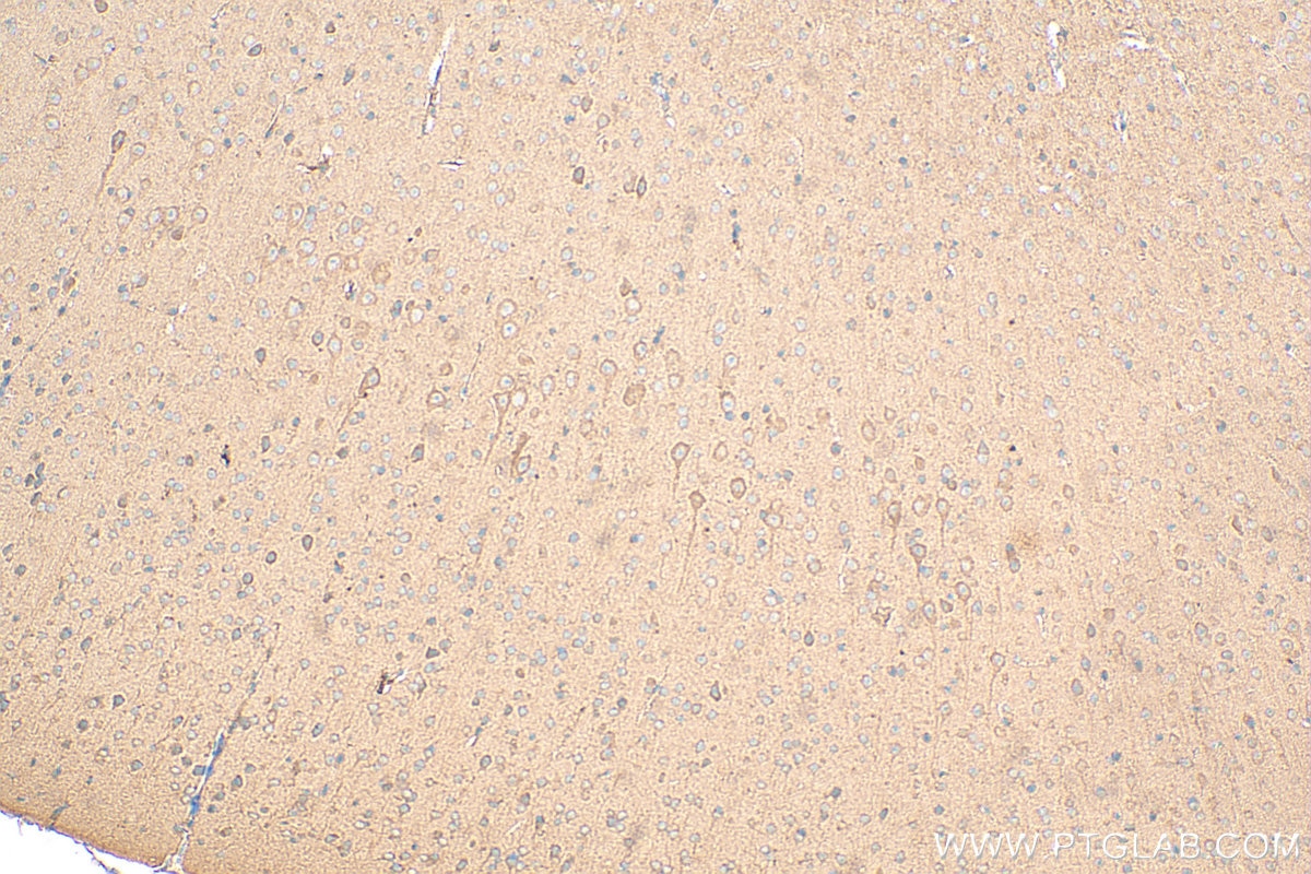 Immunohistochemistry (IHC) staining of mouse brain tissue using PPP1R15B Polyclonal antibody (14634-1-AP)