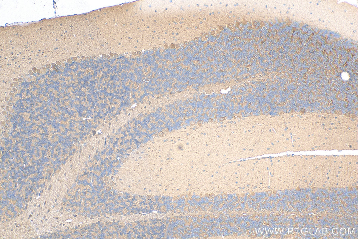 Immunohistochemistry (IHC) staining of mouse cerebellum tissue using PPP1R15B Polyclonal antibody (14634-1-AP)