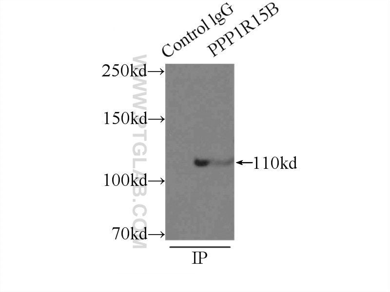 Immunoprecipitation (IP) experiment of MCF-7 cells using PPP1R15B Polyclonal antibody (14634-1-AP)