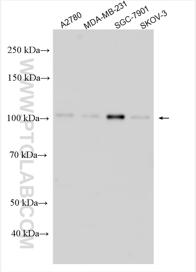 Western Blot (WB) analysis of various lysates using PPP1R15B Polyclonal antibody (14634-1-AP)