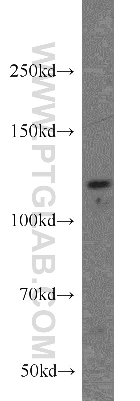 Western Blot (WB) analysis of MCF-7 cells using PPP1R15B Polyclonal antibody (14634-1-AP)