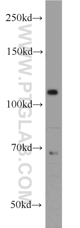 Western Blot (WB) analysis of HEK-293 cells using PPP1R15B Polyclonal antibody (14634-1-AP)