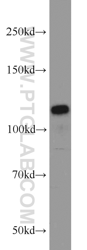 Western Blot (WB) analysis of SGC-7901 cells using PPP1R15B Polyclonal antibody (14634-1-AP)