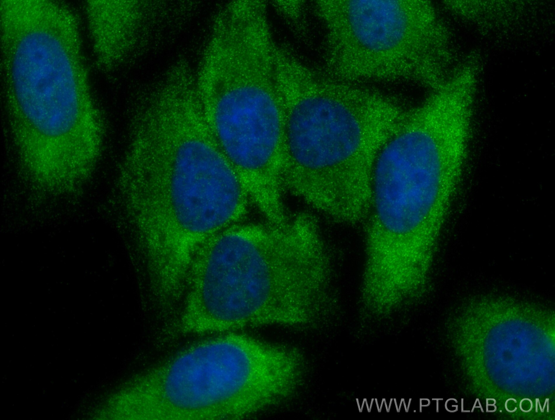 Immunofluorescence (IF) / fluorescent staining of HepG2 cells using PPP1R15B Recombinant antibody (83016-6-RR)