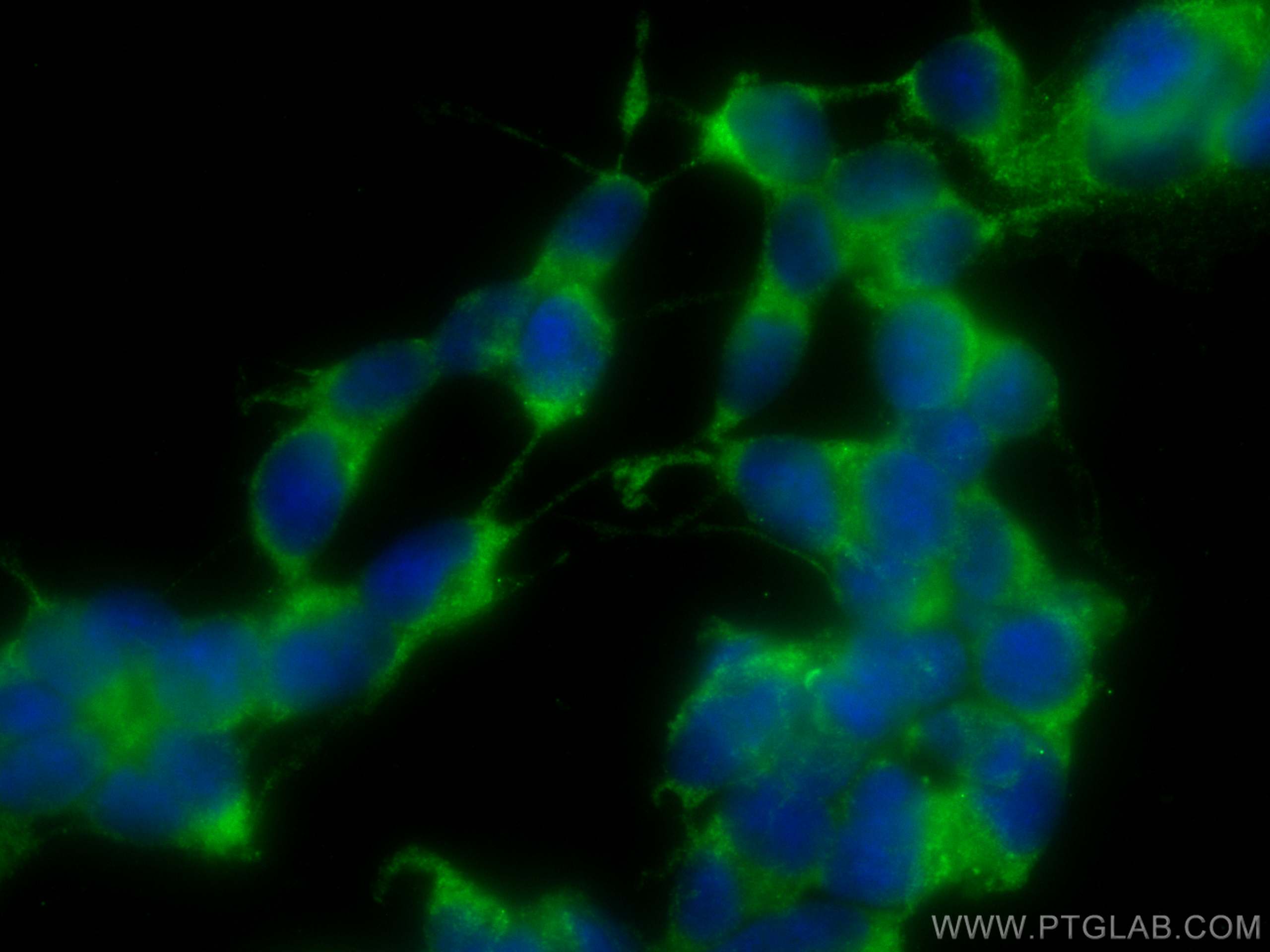 Immunofluorescence (IF) / fluorescent staining of SH-SY5Y cells using CoraLite® Plus 488-conjugated PPP1R15B Polyclonal  (CL488-14634)