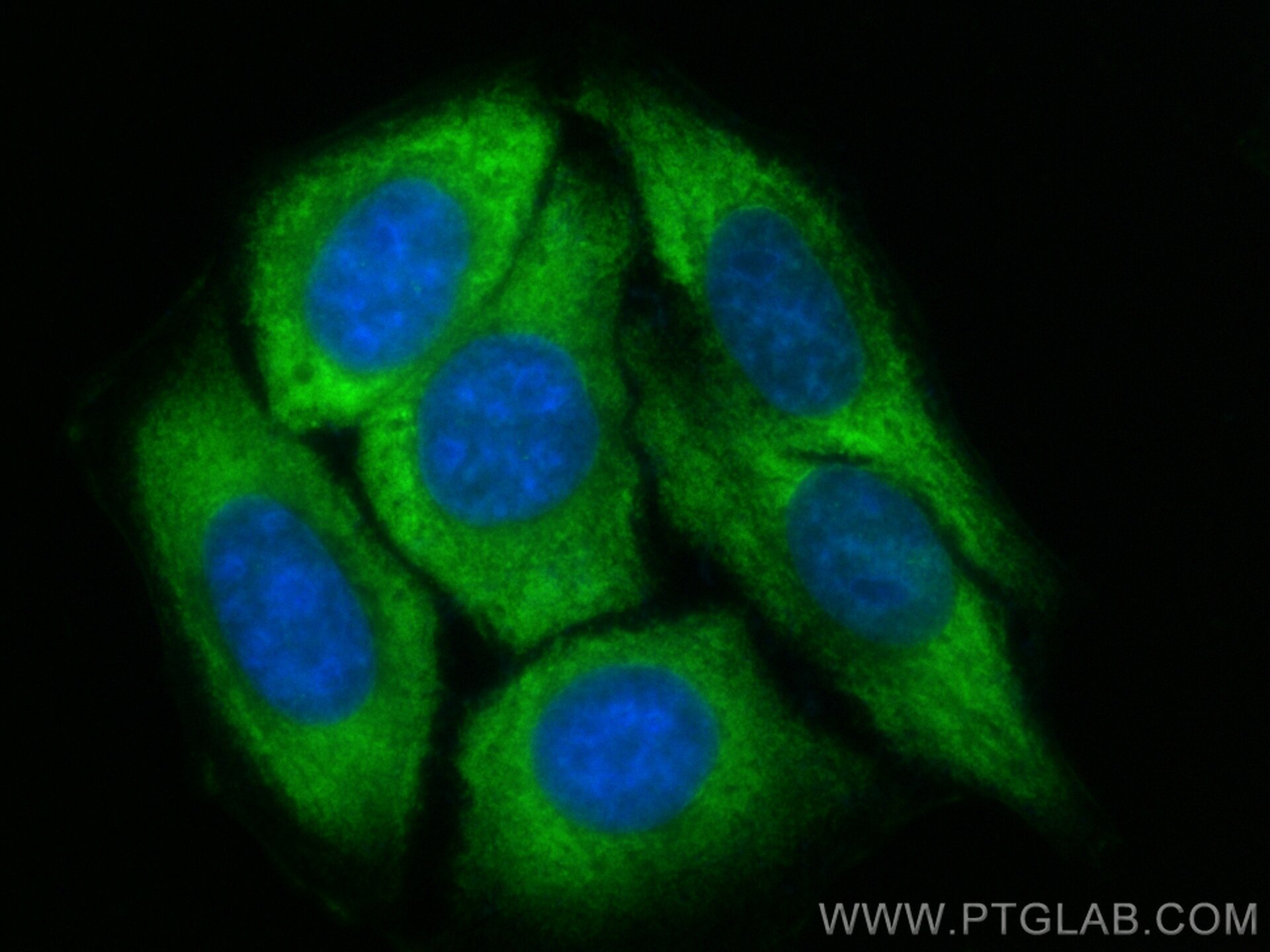 Immunofluorescence (IF) / fluorescent staining of HepG2 cells using CoraLite® Plus 488-conjugated PPP1R15B Recombinant (CL488-83016-6)