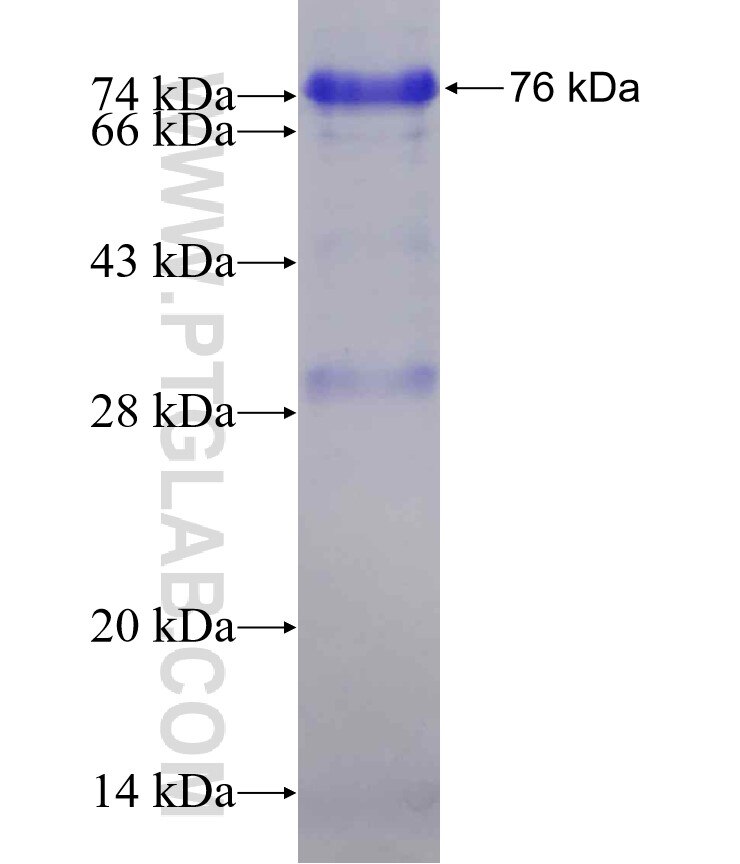 PPP1R15B;CReP fusion protein Ag6213 SDS-PAGE