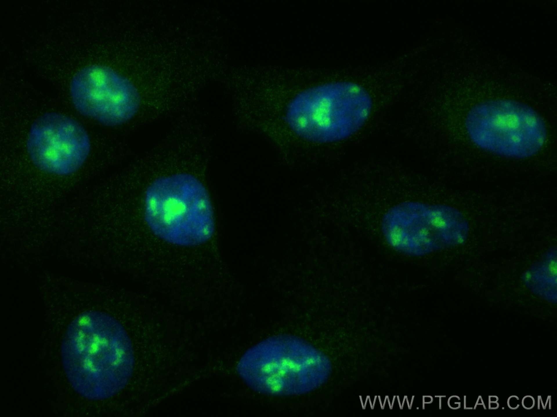 Immunofluorescence (IF) / fluorescent staining of U2OS cells using PPP1R17 Polyclonal antibody (27976-1-AP)