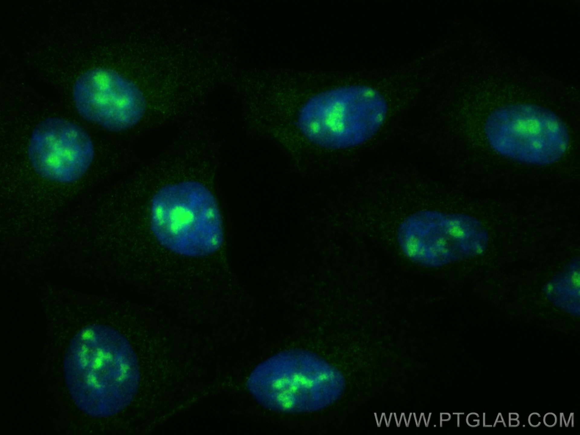 IF Staining of U2OS using 27976-1-AP