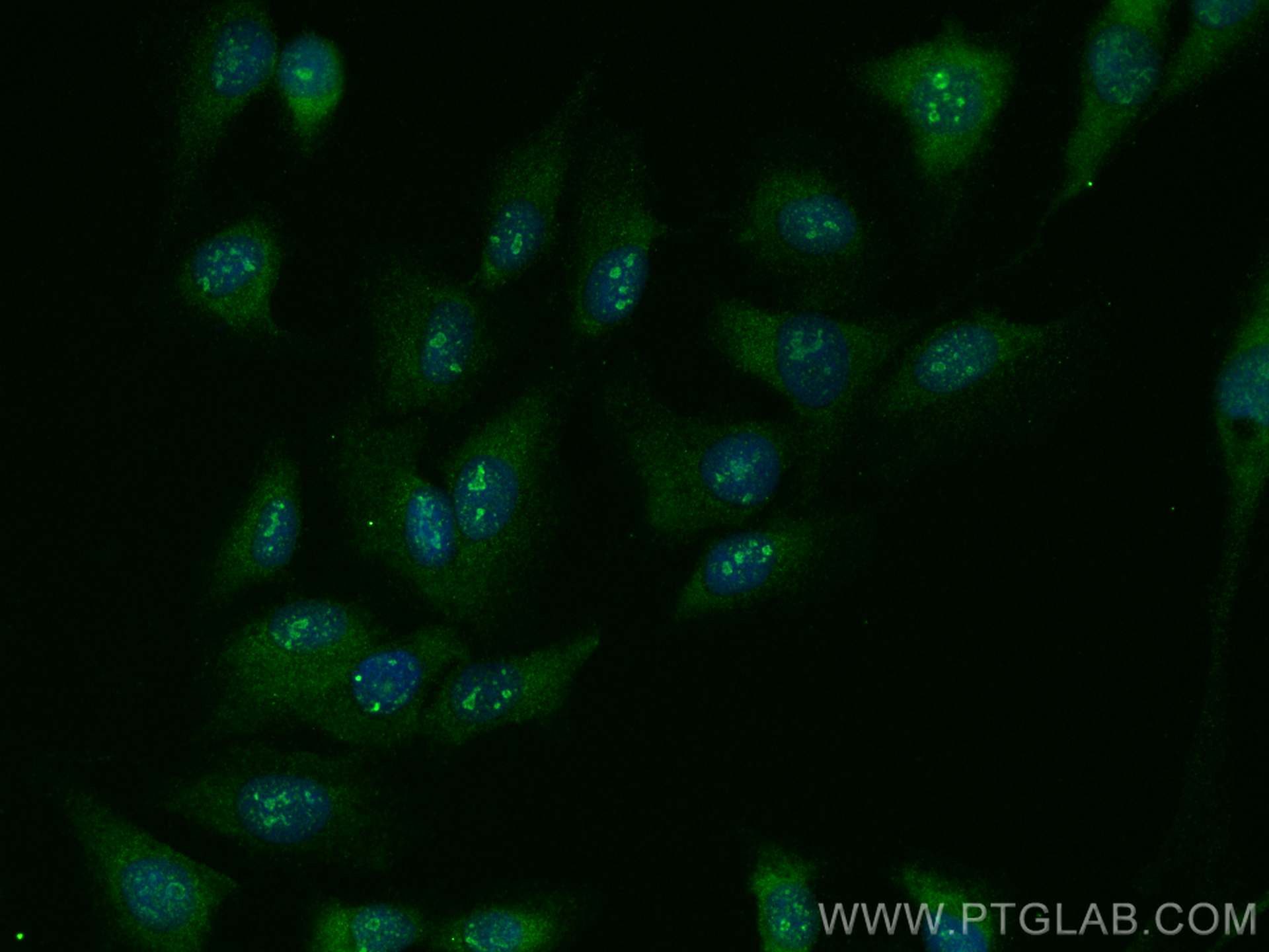 IF Staining of U2OS using 27976-1-AP