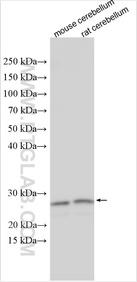 Western Blot (WB) analysis of various lysates using PPP1R17 Polyclonal antibody (27976-1-AP)