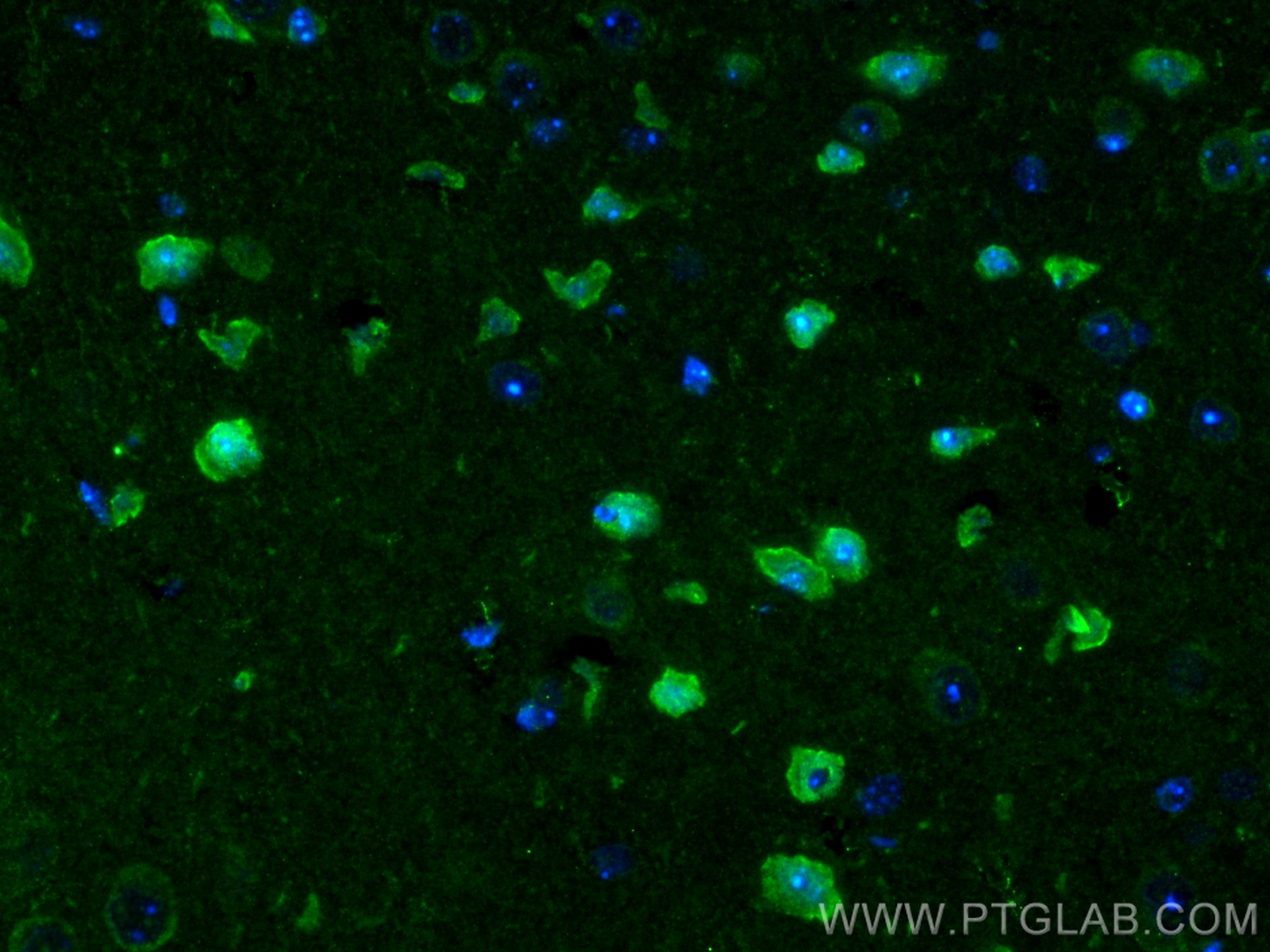 Immunofluorescence (IF) / fluorescent staining of mouse brain tissue using DARPP32/PPP1R1B Polyclonal antibody (10748-1-AP)