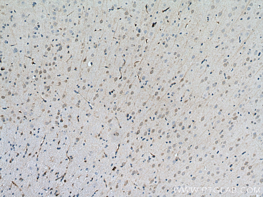 Immunohistochemistry (IHC) staining of rat brain tissue using DARPP32/PPP1R1B Polyclonal antibody (10748-1-AP)